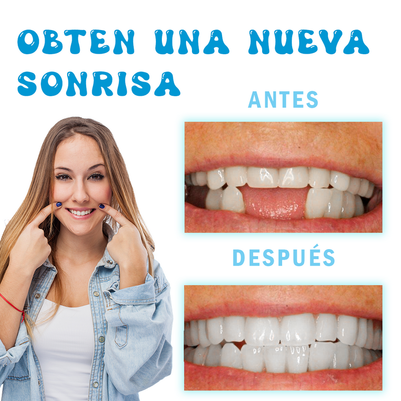 Resina de modelado dental: FlexiDent