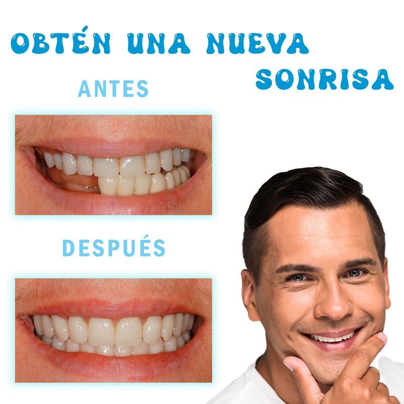 Resina de modelado dental: FlexiDent